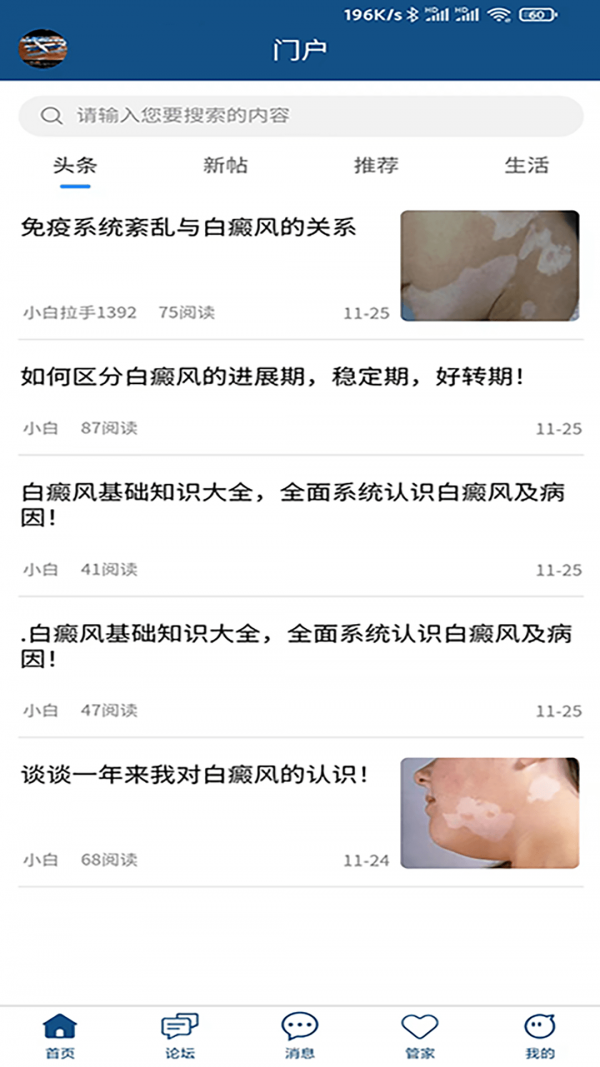 白癜风-0
