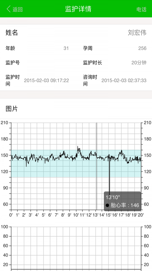 易胎心医生版-1