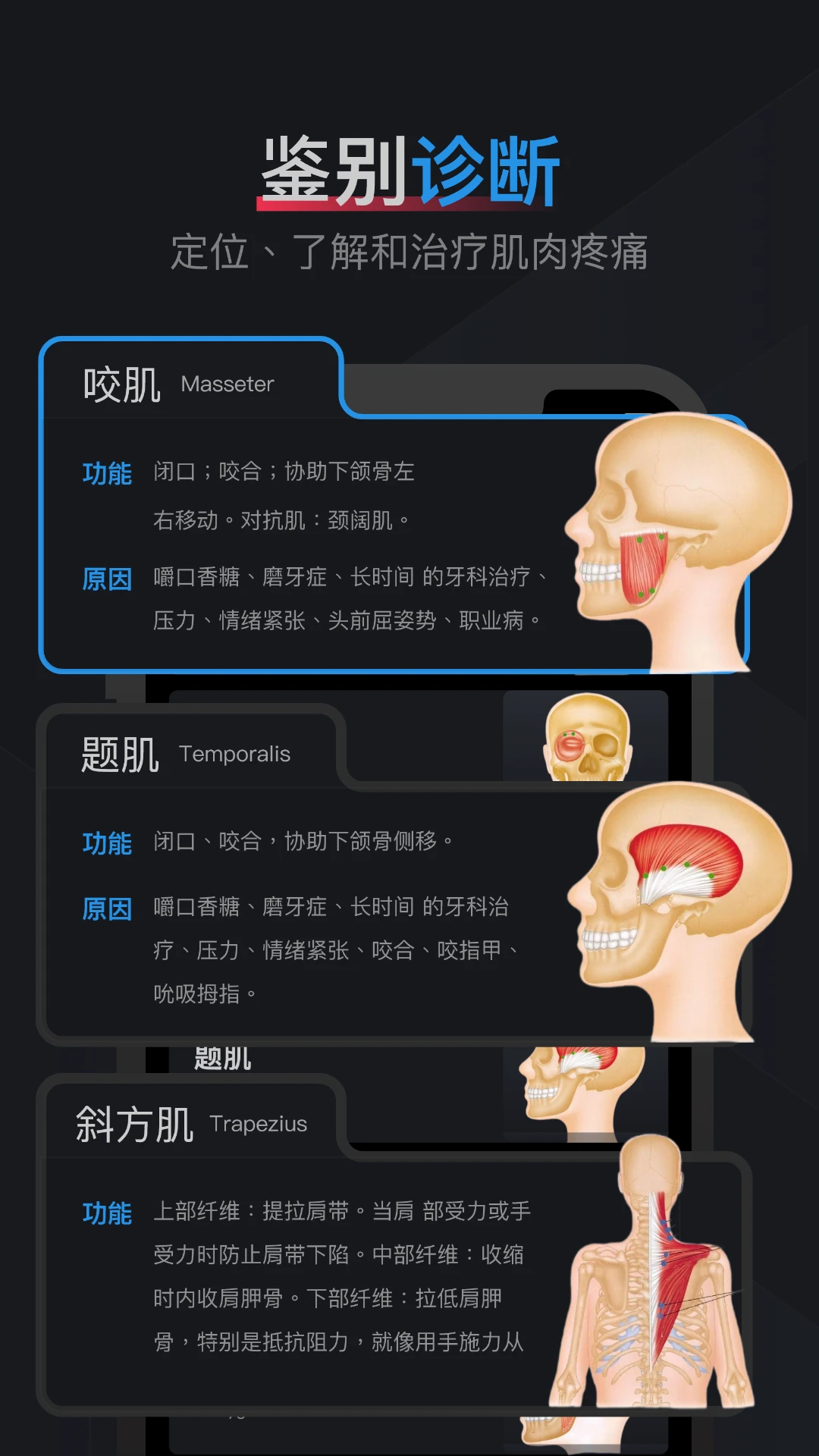 肌肉激痛点图谱-01